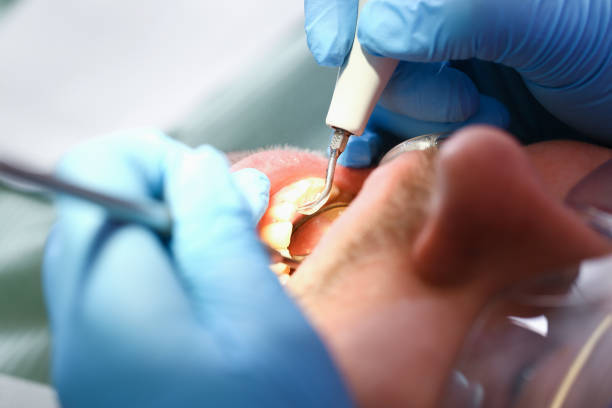 Best Chipped Tooth Repair Near Me  in Ludington, MI